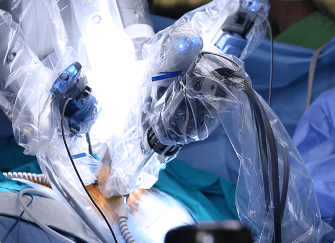 Robotic surgery the future of surgery is here now Dr. Karthik